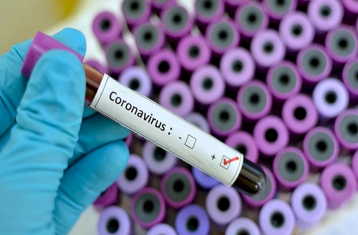 Corona Update : बिहार में एक और कोरोना पॉजिटीव,संक्रमितों की संख्या हुई 39,माइक्रोसाफ्ट के संस्थापक बिल गेटस् ने दिए 15 हजार कोरोना जांच किट