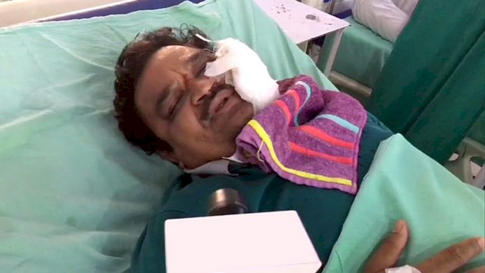 Corona Update : डॉक्टरों पर हमला करनेवालों की अब खैर नहीं,नरेंद्र मोदी सरकार लाई स्वास्थ्यकर्मियों की सुरक्षा का अध्यादेश,7 साल तक की सजा और 5 लाख तक जुर्माने का प्रावधान