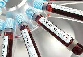 Corona Update : भारत में जारी है कोरोना का कहर, 50 हजार के करीब पहुंची संक्रमितों की संख्या, 24 घंटों में 2958 नए मरीजों की हुई पुष्टि,126 लोगों ने तोड़ा दम