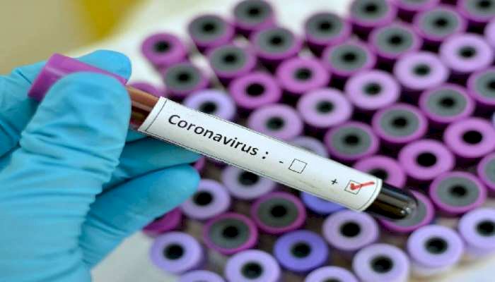 Corona Update : कोरोना वायरस ने बिहार को भी किया बेहाल,38 में से 37 जिलों में कोरोना ने पसारे पैर, 600  के करीब हुई संक्रमितों की संख्या