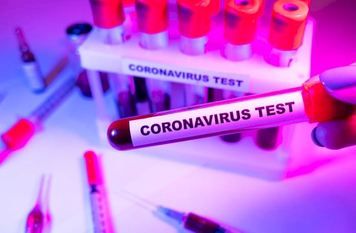 देश में और बढ़ी कोरोना वायरस के प्रसार की रफ्तार,24 घंटों में आए 10,956 नए मामले,कोरोना संक्रमितों के मामले में चौथे स्थान पर पहुंचा भारत,8,498 लोगों की हो चुकी है मौत