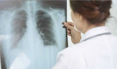 कर्नाटक में कोरोना को मात दे चुके मरीज हो रहे हैं टीबी के शिकार, बचाव के लिए सरकार ने उठाया यह कदम